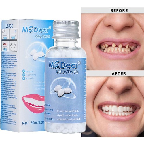 Kit fake teeth permanent - fake,