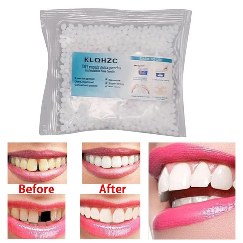 Teeth repair kit 25g moldable - repair,