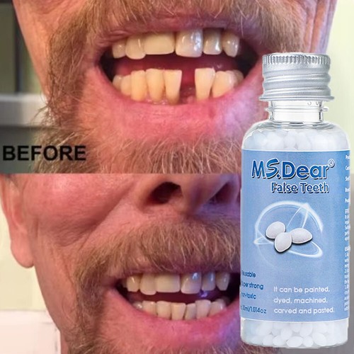 Strong teeth tooth repair - teeth,