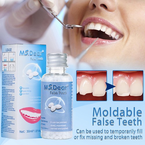 Moldable teeth tooth - teeth, repair
