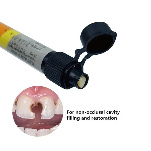 New dental cement cavity - new,