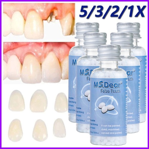 Strong teeth tooth repair - tooth,