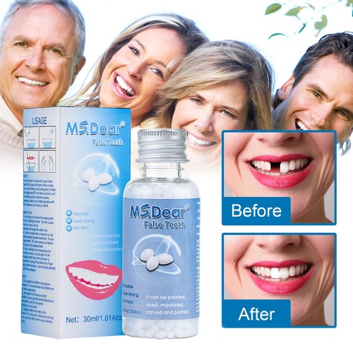 Temporary tooth filling - temporary,