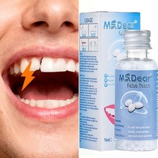 Moldable Teeth Tooth Repair