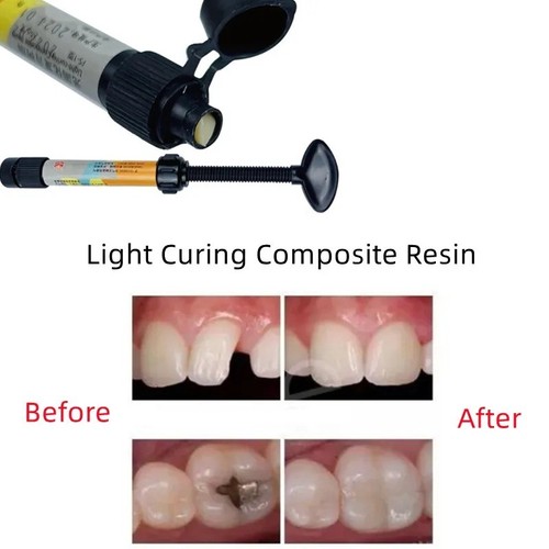 New dental cement tooth - dental, cavity