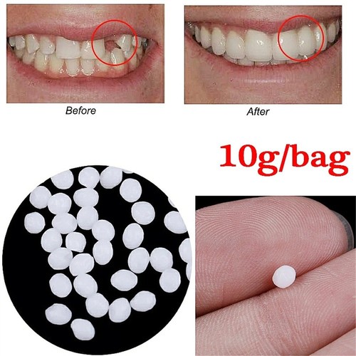 Temporary tooth repair kit - temporary,